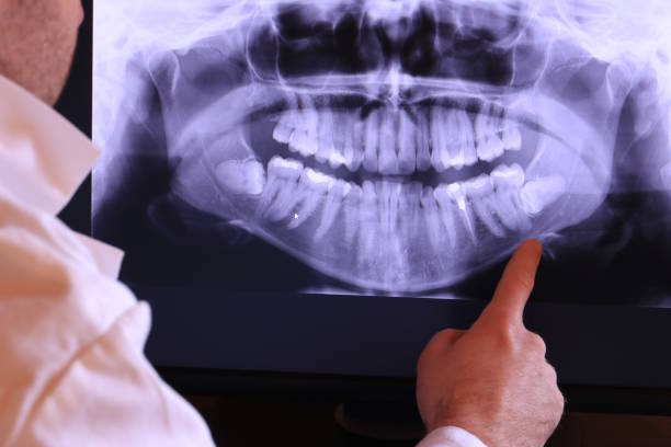 Best Tooth Infection Emergency Dentist  in Bellows Falls, VT