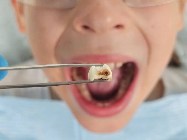 Best Tooth Pain Emergency Relief  in Bellows Falls, VT
